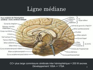 Corps calleux courts, complets, isolés : prévalence, comparaison entre échographie et IRM et devenir à court terme.