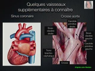 L' examen du coeur Connaître l'anatomie indispensable : position du coeur dans le thorax, les cavités, les gros vaisseaux, les niveaux de coupe :