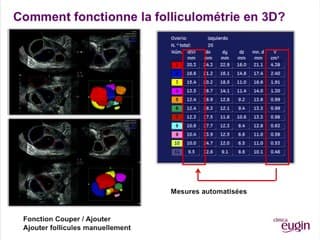 Comptage automatique des follicules Pour :