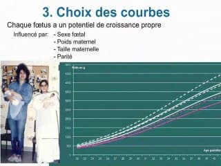 Croissance foetale, quelles tendances ? Recommandations du CNGOF