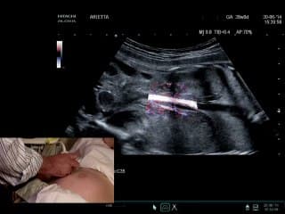 Démonstration live : réaliser l’examen de l’appareil urinaire en pratique, du dépistage à la caractérisation des images.