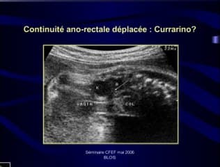 Les organes génitaux externes
