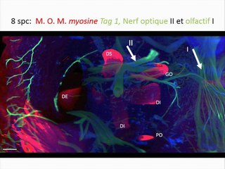 Nouvelle imagerie embryofœtale humaine du premier trimestre de gestation.