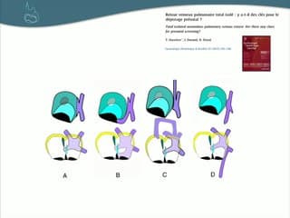 quizz Imagerie du coeur RVPAT