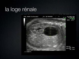 Mise au point sur le bilan échographique d’une image liquidienne inhabituelle intra- abdominale