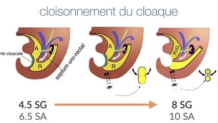 sinus urogénital versus malformation cloacale ?
