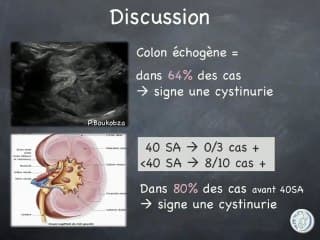 Conduite à tenir en cas de colon hyperéchogène (dépistage de la cystinurie-lysinurie)