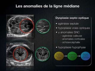 La ligne médiane : que contrôler, pour quels diagnostics ?