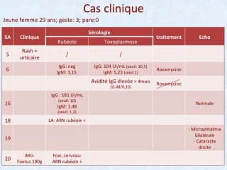 Rubéole et grossesse : pièges