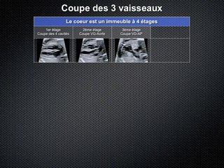 POSTER Coupe 3Vx
