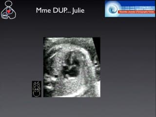 Des mots pour le dire