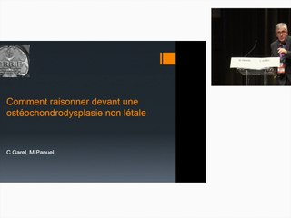 Comment raisonner devant une ostéochondrodysplasie non  létale.