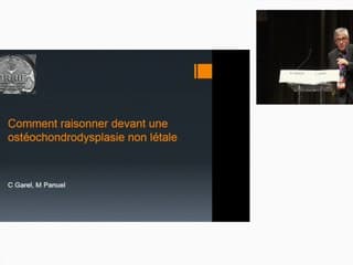 Comment raisonner devant une ostéochondrodysplasie non  létale.