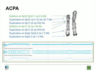 23 Quand le chromoanalysis s'invite en prénatal: à propos d'un cas