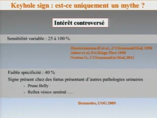 Keyhole sign dans les VUP : mythe ou réalité ?