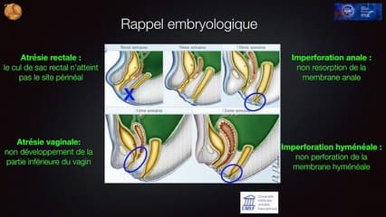 écho anatomie normale de la région abdomino pelvienne