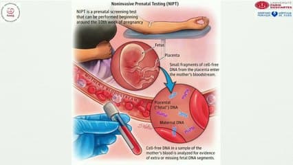 Dépistage des anomalies chromosomiques et des anomalies associées I) Choix et stratégies › Riques intermédiaires : DPNI ou amniocentèse ?