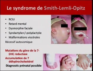 Conduite à tenir devant une polydactylie