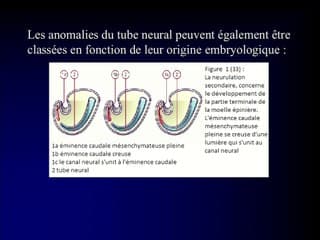 Diagnostic des anomalies médullaires.