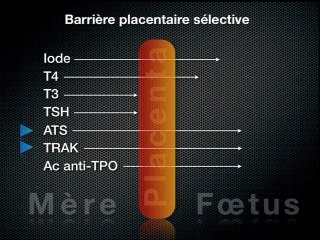 Thyroïde foetale