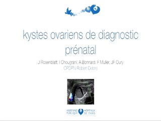 Kystes ovariens de diagnostic prénatal