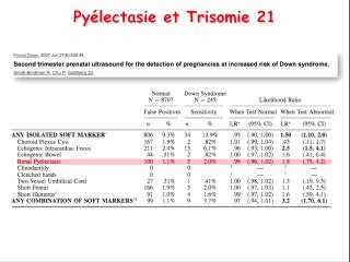 Quand faut-il faire un caryotype dans le cadre d'une uropathie ?