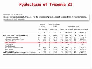 Quand faut-il faire un caryotype dans le cadre d'une uropathie ?