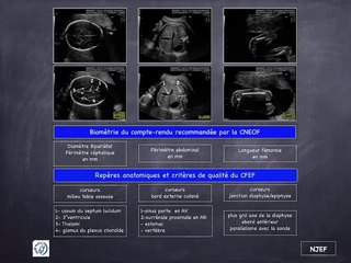 POSTER Biométrie CNEOF