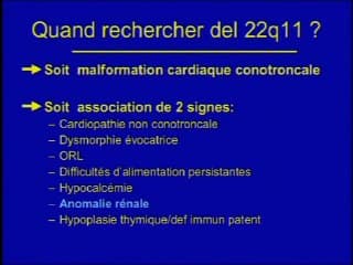 Quand soupçonner un syndrome Vélo-Cardio-Facial chez un nouveau-né ?