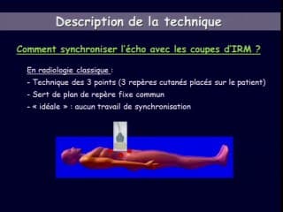 Fusion d’image,  et cerveau fœtal quelle utilité ?