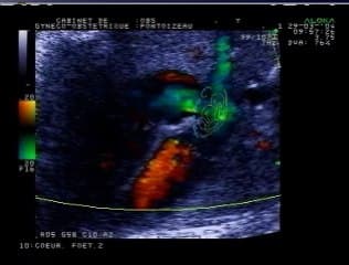 Croix du cœur : critères de qualité