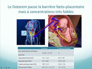 Flash info : Que peuvent nous dire échographie et IRM de la fonction placentaire ?