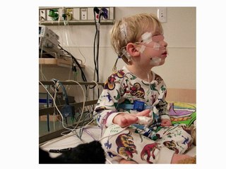 PRISE EN CHARGE RESPIRATOIRE DES NOUVEAU-NÉS PORTEURS D’UNEMALFORMATIONFACIALE