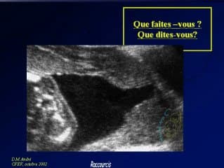 Cicatrice d'hystérotomie