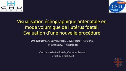 41 Visualisation echographique anténatale en mode volumique de l'utérus fœtal: evaluation d'une nouvelle procédure