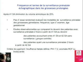 Intér't des dopplers en salle de travail (utérin, ombilical, cérébral)
