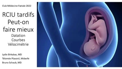 RCIU tardifs : peut-on faire mieux ? Datation, Courbes, Vélocimétrie