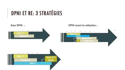 Réduction embryonnaire et DPNI : enquête auprès des CPDPN
