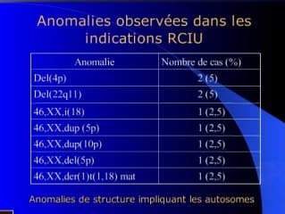 Quand demander un caryotype foetal devant un signe échographique au 2eme trimestre ? RCIU