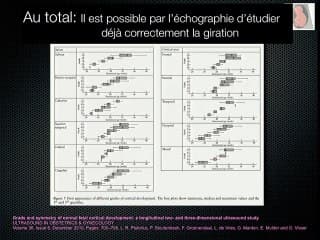 5 Pathologies du cerveau foetal trouble de gyration