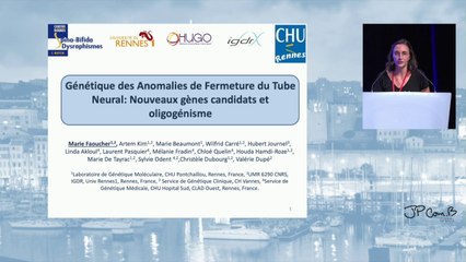 Le séquençage haut-débit sur une cohorte de 56 patients atteints d’anomalies du tube neural renforce l’implication des gènes de la polarité planaire cellulaire et de la voie Sonic Hedgehog