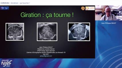 Giration : ça tourne !