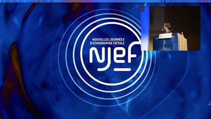 Le point sur les travaux du CFEF, en cours et à venir