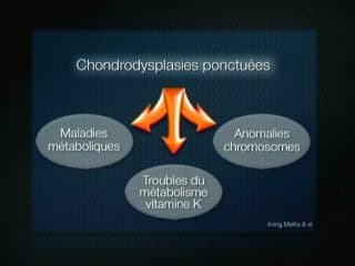 binder chondrodysplasie ponctuée