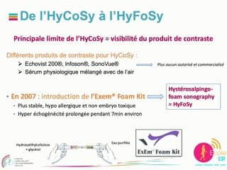 Place de l’HyFoSy dans la stratégie de l’exploration tubaire chez la femme infertile