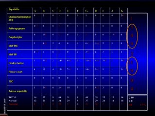 Quand demander un caryotype foetal devant un signe échographique au 2eme trimestre ? Squelette et os longs courts. Pieds bots, Malf génito-urinaires