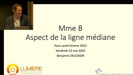 Analyse échographique de la ligne médiane et orientations étiologiques