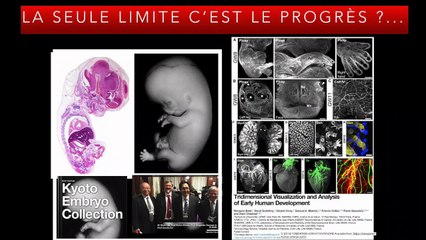 1er Trimestre Différents niveaux de lecture des coupes du 1er trimestre