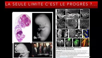 1er Trimestre Différents niveaux de lecture des coupes du 1er trimestre