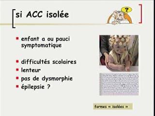 5 Pathologies du cerveau foetal agénésie du corps calleux